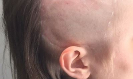 Entreprise hautement spécialisée dans les solutions pour les problèmes de cheveux et de cuir chevelu image